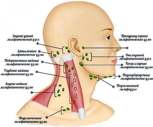 Болят лимфоузлы на шее: причины, что делать и как лечить